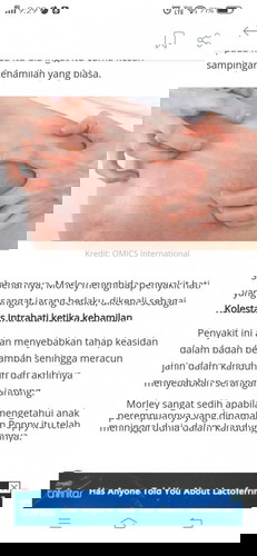 Sy ada tbaca psl ni sb saya skrng ni mgalami gatal2 yg luar biasa, gatal ni timbul sebelum prgnt lg