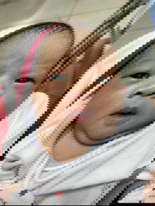 เป็นสิวข้าวสาร