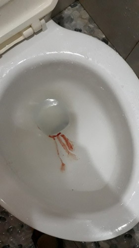 Bleeding while preganant