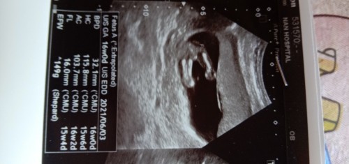 รูปนี้ได้ลูกสาวหรือลูกชายค่ะช่วยบอกหน่อยค่ะดูไม่เป็นค่ะ