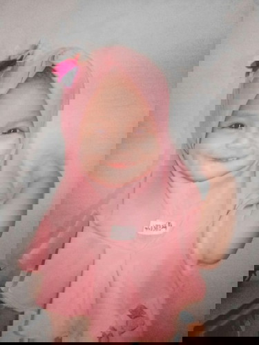 3 x USG diperkirakan laki-laki.