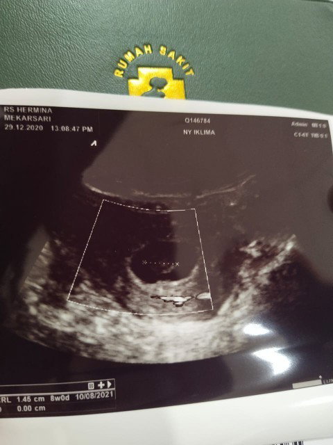 Hamil 8w1d keluar flek