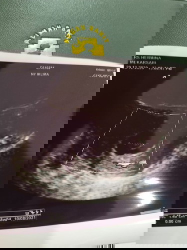 Hamil 8w1d keluar flek