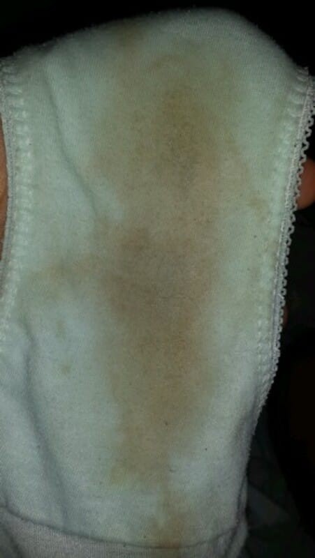 Cervix 2-3cm bumalik 1cm???