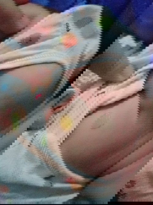 กังวลมาก ลูกแม่ๆคนไหนเป็นตุ่มพองใสๆบ้าง