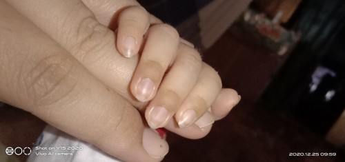 aileen kerap nangis mlm di sebab kn perut kembung
