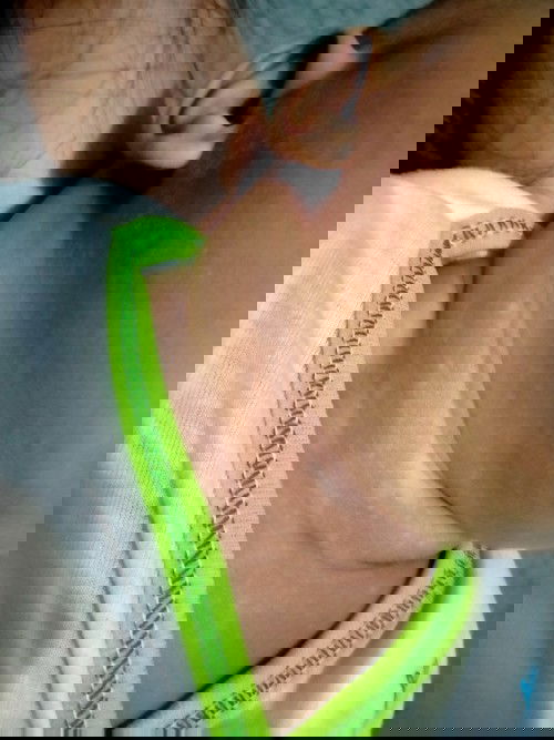 Bercak putih pada bayi