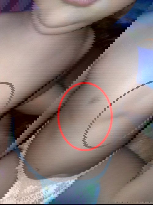 Dada anak usia 8 bulan