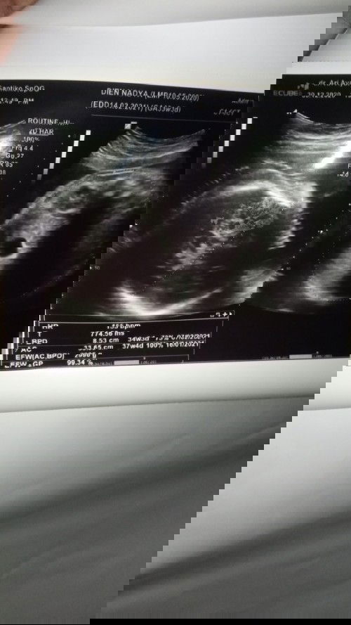 Usia kandungan dan bbj