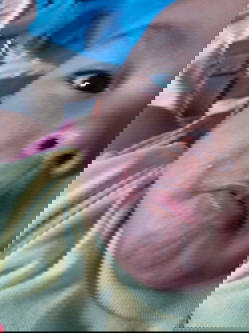 Gatal" seluruh badan