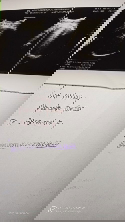 Sering konpal saat mendekati hpl