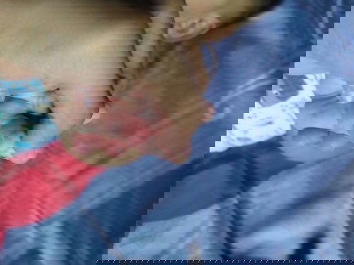 Kelingkingnya macam melepuh