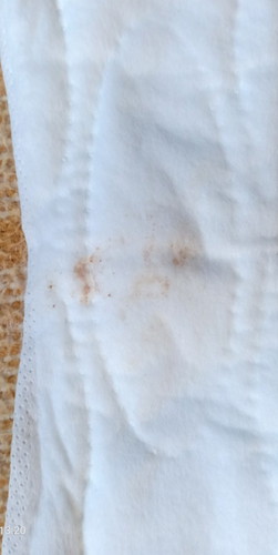 Implantation Bleeding?