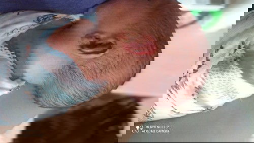 Kepala peyang atau tidak