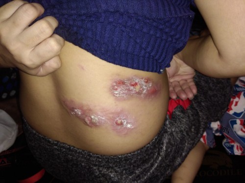 Hi mga mom's ask ko lang po ano po pdeng igamot sa mamaso ng buntis? Salamat po sa sasagot☺️☺️☺️☺️☺️
