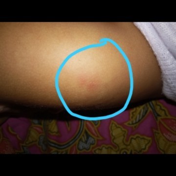 Imunisasi penta bio 1