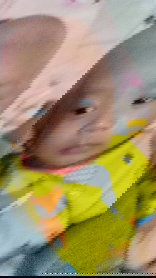 Kepala dibotakin jadi rewel