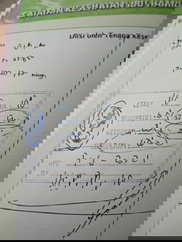 Tanya hasil usg
