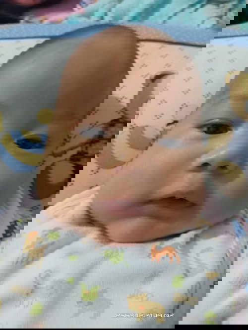 อาการ Overfeeding