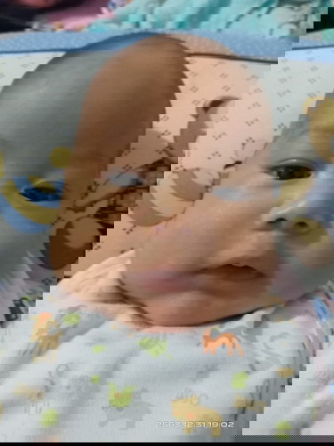 อาการ Overfeeding