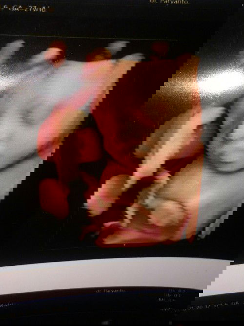 Sudah bisa terbuka kah..