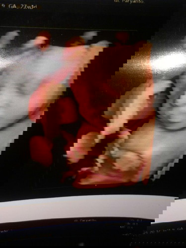 Sudah bisa terbuka kah..