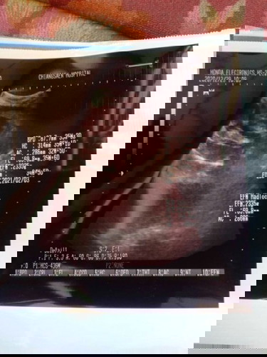 แม่ๆค่ะช่วยดูให้หน่อยค่ะว่าผู้หญิงผู้ชาย แต่หมอบอกผู้หญิง