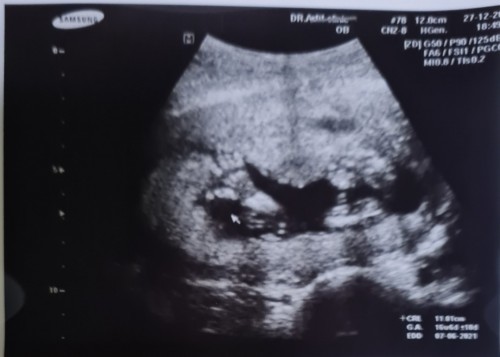 สวัสดีปีใหม่ แม่ๆทุกคนค่ะ