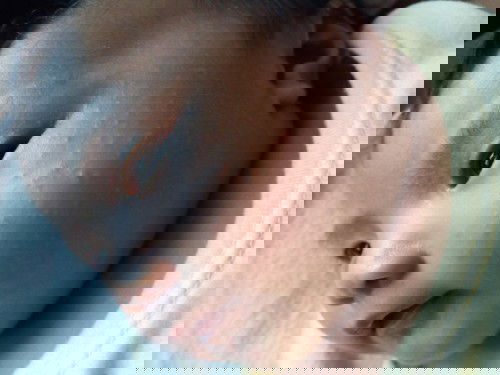 Pahelp naman po sa baby rash