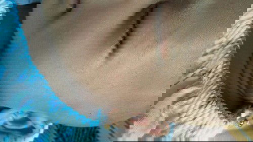 Bintik2 merah di wajah dan kepala