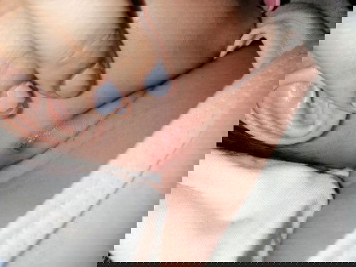 Ano po ba ito ang nasa leeg ni baby? Ano po gamot?