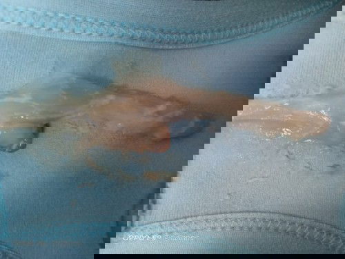 ใช่มูกเลือด