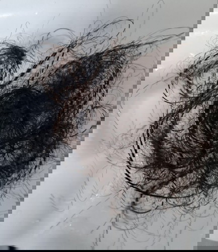 Hair loss after birth