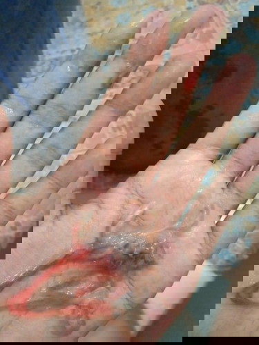 อันตรายไมคะ