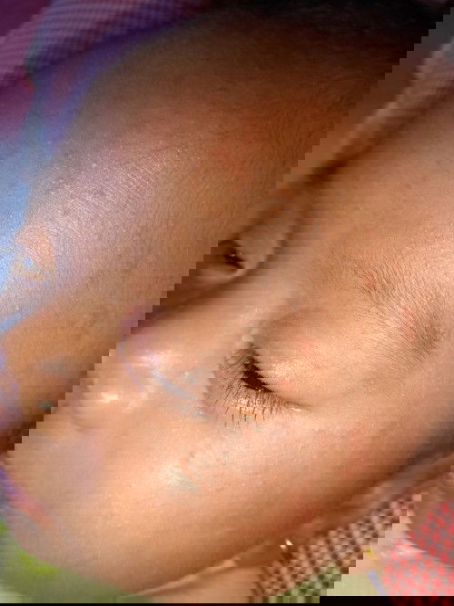 Bayi usia 1bulan 15hari