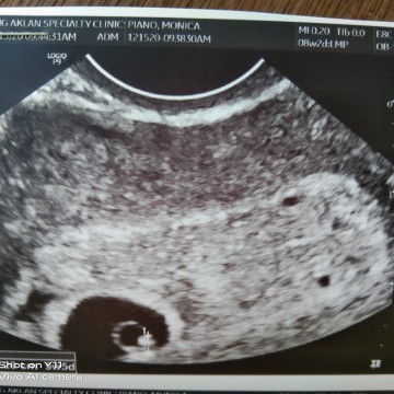 Buntis ako ng 2months and 2days ngayon