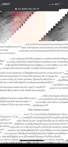 ตุ่ม บนผิวหนัง