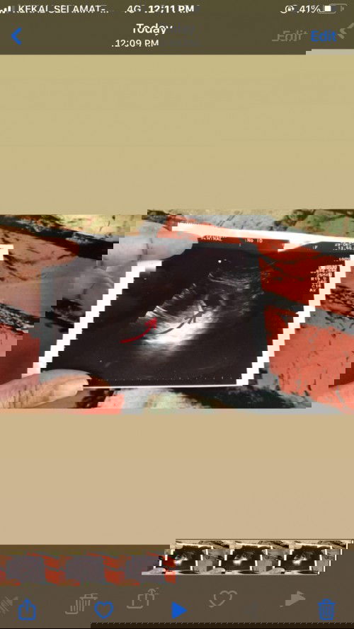 Tentang Scan 4-5 week  🧐