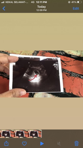 Tentang Scan 4-5 week 🧐