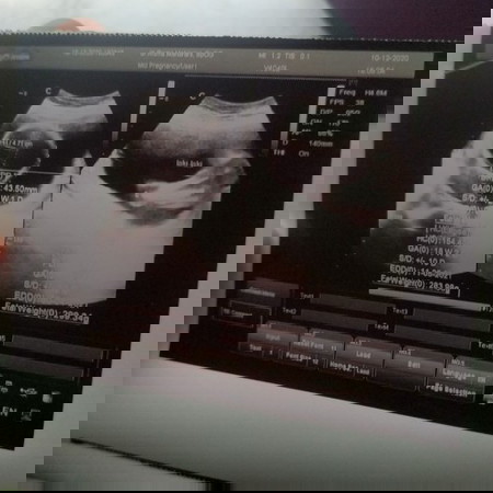 Cara meliat wajah bayi lewat aplikasi ini gimna caranya