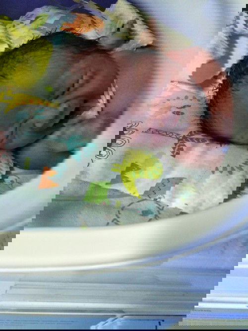 minggu ke 34 pecah ketuban