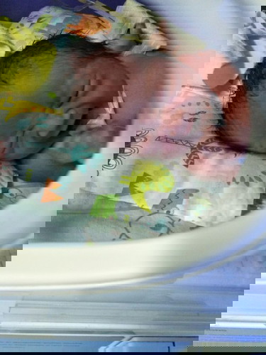 minggu ke 34 pecah ketuban