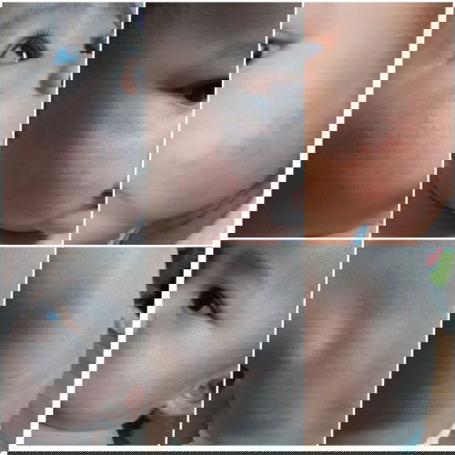 น้องเป็นผื่นค่ะ เป็นจุดๆแต่หลายจุด
ขึ้นที่แก้ม แล้วก้หลัง แม่ๆๆท่านไหนพอจะทราบมั้ยคะ ว่าเกิดจากอะไร