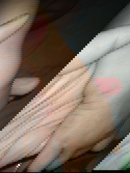 Gatal gatal pada bayi 10 bulan