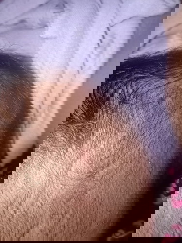 mau tanya ,knapa kepala anaku ada bintik bintik nanah gitu ya sejak lahir,baru usia lima hari