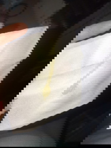 มูกก่อนคลอด.