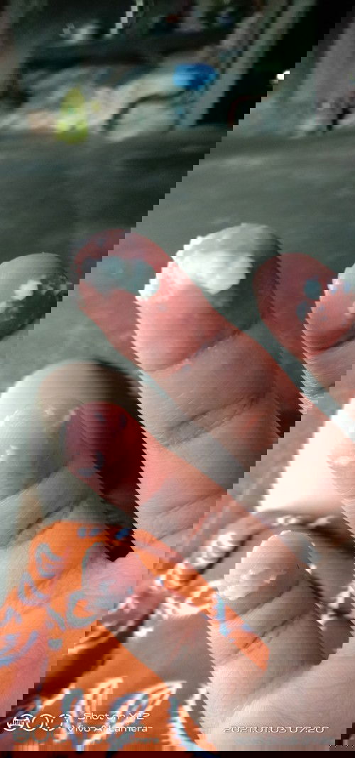 Keluar keputihan seperti putih telur UK 30 week