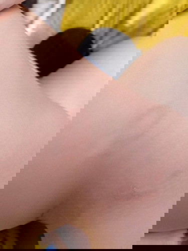 ลูกวัย7เดือนเป็นผื่น เป็นๆหายๆ