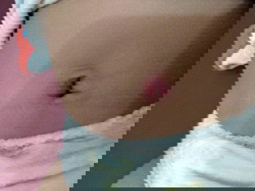 Pusar merah bayi 4 bulan