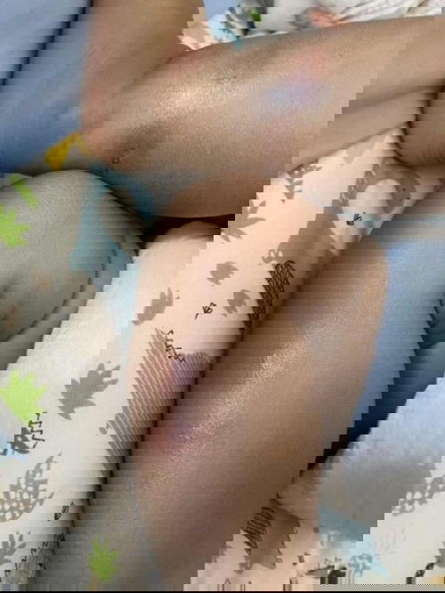 ลูกใครเป็นแบบนี้บ้างคะปกติไหม